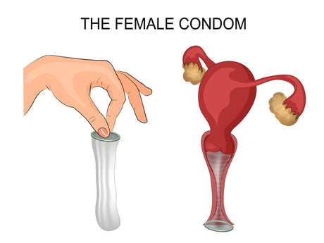 The Growth And Growth Of The Female Condom
